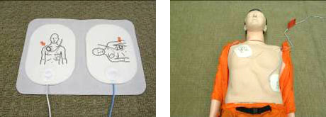 パッドを貼る場所が印刷されているAEDのパッドと、図に従って訓練用の人形に貼った状態